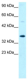 WB Suggested Anti-GTF2H3 Antibody Titration: 0.2-1 ug/ml; ELISA Titer: 1:2500; Positive Control: Jurkat cell lysateGTF2H3 is supported by BioGPS gene expression data to be expressed in Jurkat