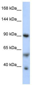 WB Suggested Anti-PPARGC1A Antibody Titration: 0.2-1 ug/ml; ELISA Titer: 1:62500; Positive Control: Jurkat cell lysate
