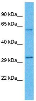 Host: Rabbit; Target Name: ZDHHC19; Sample Tissue: Lypho Node Tumor lysates; Antibody Dilution: 1.0ug/ml