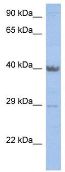 WB Suggested Anti-ZNF474 Antibody Titration: 0.2-1 ug/ml; ELISA Titer: 1:62500; Positive Control: Human Stomach