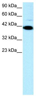 WB Suggested Anti-ZFP1 Antibody Titration: 0.2-1 ug/ml; ELISA Titer: 1:312500; Positive Control: Jurkat cell lysate