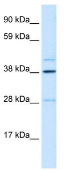 WB Suggested Anti-LASS3 Antibody Titration: 0.2-1 ug/ml; ELISA Titer: 1:12500; Positive Control: Human Liver