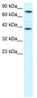 WB Suggested Anti-ZNF652 Antibody Titration: 0.2-1 ug/ml; ELISA Titer: 1:312500; Positive Control: Hela cell lysateZNF652 is supported by BioGPS gene expression data to be expressed in HeLa