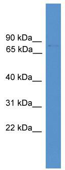 WB Suggested Anti-Foxj3 Antibody Titration: 0.2-1 ug/ml; ELISA Titer: 1:12500; Positive Control: Mouse Small Intestine