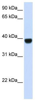 WB Suggested Anti-FOXE1 Antibody Titration: 0.2-1 ug/ml; ELISA Titer: 1:62500; Positive Control: Human Muscle