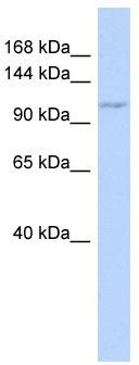 WB Suggested Anti-ZC3H7B Antibody Titration: 0.2-1 ug/ml; ELISA Titer: 1:312500; Positive Control: 721_B cell lysateThere is BioGPS gene expression data showing that ZC3H7B is expressed in 721_B