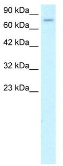 WB Suggested Anti-ZFP95 Antibody Titration: 1.0ug/ml; ELISA Titer: 1:62500; Positive Control: Jurkat cell lysate
