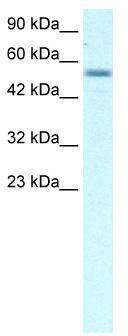 WB Suggested Anti-EBF3 Antibody Titration: 2.5 ug/ml; ELISA Titer: 1:62500; Positive Control: Raji cell lysate