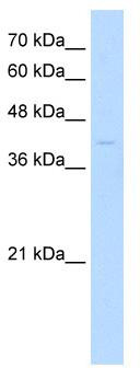 WB Suggested Anti-MKX Antibody Titration: 0.2-1 ug/ml; ELISA Titer: 1:62500; Positive Control: Jurkat cell lysate