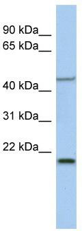 Host: Rabbit Target Name: DZIP1 Sample Tissue: Human 293T Whole Cell Antibody Dilution: 1.0ug/ml