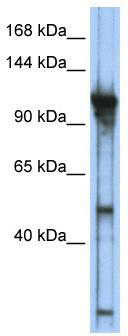 WB Suggested Anti-GTF3C2 Antibody Titration: 0.2-1 ug/ml; ELISA Titer: 1:12500; Positive Control: Transfected 293T