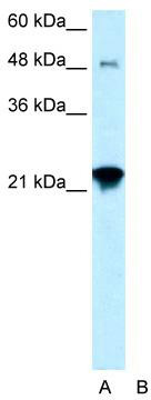 WB Suggested Anti-LASS2 Antibody Titration: 0.2-1 ug/ml; Positive Control: HepG2 cell lysateCERS2 is supported by BioGPS gene expression data to be expressed in HepG2