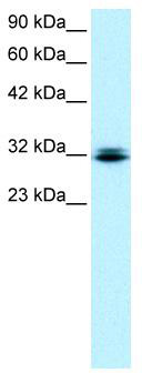 WB Suggested Anti-RAX Antibody Titration: 0.2-1 ug/ml; ELISA Titer: 1:12500; Positive Control: Jurkat cell lysate