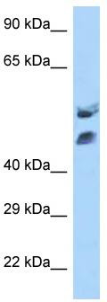 WB Suggested Anti-HOXA13 Antibody Titration: 0.2-1 ug/ml; ELISA Titer: 1:62500; Positive Control: Jurkat cell lysate