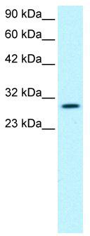 WB Suggested Anti-JMJD8 Antibody Titration: 0.2-1 ug/ml; ELISA Titer: 1:312500; Positive Control: Jurkat cell lysate