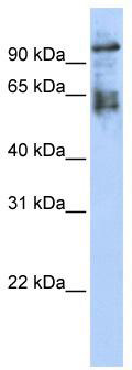 WB Suggested Anti-ZNF43 Antibody Titration: 0.2-1 ug/ml; ELISA Titer: 1:312500; Positive Control: 293T cell lysate ZNF43 is strongly supported by BioGPS gene expression data to be expressed in Human HEK293T cells