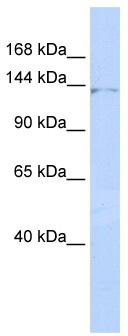 WB Suggested Anti-ZNF445 Antibody Titration: 0.2-1 ug/ml; ELISA Titer: 1:62500; Positive Control: HepG2 cell lysate