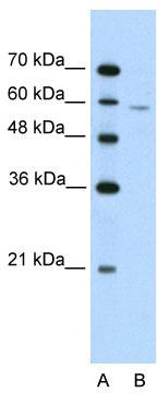WB Suggested Anti-IRX4 Antibody Titration: 2.5ug/ml; Positive Control: Jurkat cell lysate