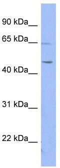 WB Suggested Anti-RNF12 Antibody Titration: 0.2-1 ug/ml; ELISA Titer: 1:62500; Positive Control: HT1080 cell lysateRLIM is supported by BioGPS gene expression data to be expressed in HT1080