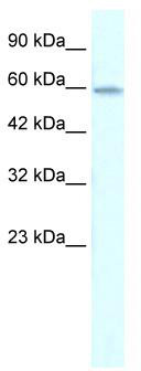 WB Suggested Anti-ZNF543 Antibody Titration: 0.2-1 ug/ml; Positive Control: Jurkat cell lysate