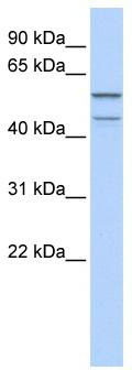 WB Suggested Anti-ZNF474 Antibody Titration: 0.2-1 ug/ml; ELISA Titer: 1:312500; Positive Control: Human brain