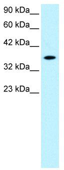WB Suggested Anti-RAX Antibody Titration: 0.2-1 ug/ml; Positive Control: Jurkat cell lysate