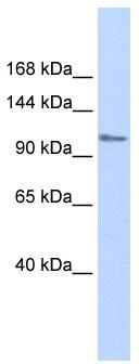 WB Suggested Anti-ZFPM1 Antibody Titration: 0.2-1 ug/ml; ELISA Titer: 1:62500; Positive Control: Human Muscle