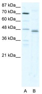 WB Suggested Anti-ZFP1 Antibody Titration: 2.5ug/ml; ELISA Titer: 1:1562500; Positive Control: HepG2 cell lysate