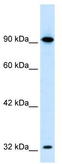 WB Suggested Anti-SOX30 Antibody Titration: 0.2-1 ug/ml; ELISA Titer: 1:312500; Positive Control: HepG2 cell lysate