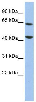 WB Suggested Anti-FOXJ3 Antibody Titration: 0.2-1 ug/ml; ELISA Titer: 1:312500; Positive Control: HepG2 cell lysate