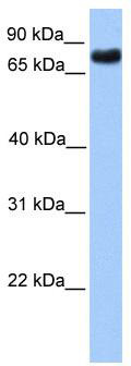 WB Suggested Anti-TLE2 Antibody Titration: 0.2-1 ug/ml; Positive Control: Transfected 293T