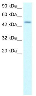 WB Suggested Anti-ALX4 Antibody Titration: 0.2-1 ug/ml; Positive Control: Jurkat cell lysate