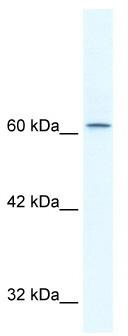 WB Suggested Anti-TLE3 Antibody Titration: 2.5ug/ml; Positive Control: HepG2 cell lysate