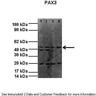 Lanes: ; Lane 1: 20ug RH30 lysate; Lane 2: 20ug RH30 lysate; Lane 3: 20ug RH41 lysate; Lane 4: 20ug RH41 lysate; Primary Antibody Dilution: ; 1:1000; Secondary Antibody: ; Donkey anti-rabbit HRP; Secondary Antibody Dilution: ; 1:4000; Gene Name: ; PAX3; Submi