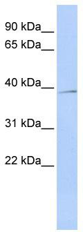 WB Suggested Anti-SIRT4 Antibody Titration: 0.2-1 ug/ml; ELISA Titer: 1:62500; Positive Control: MCF7 cell lysate