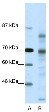 WB Suggested Anti-NCOR2 Antibody Titration: 0.2-1 ug/ml; Positive Control: Hela cell lysateNCOR2 is supported by BioGPS gene expression data to be expressed in HeLa