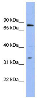 WB Suggested Anti-PATZ1 Antibody Titration: 0.2-1 ug/ml; ELISA Titer: 1:312500; Positive Control: OVCAR-3 cell lysate