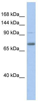 WB Suggested Anti-ZKSCAN5 Antibody Titration: 0.2-1 ug/ml; ELISA Titer: 1:312500; Positive Control: Human Stomach