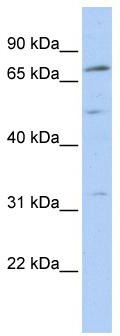 WB Suggested Anti-NR6A1 Antibody Titration: 0.2-1 ug/ml; ELISA Titer: 1:312500; Positive Control: MCF7 cell lysate