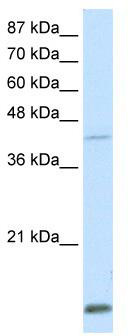 WB Suggested Anti-MKX Antibody Titration: 0.2-1 ug/ml; Positive Control: Transfected 293T