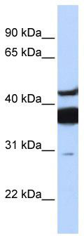 WB Suggested Anti-LASS2 Antibody Titration: 0.2-1 ug/ml; ELISA Titer: 1:312500; Positive Control: Human brain