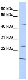 WB Suggested Anti-BARHL2 Antibody Titration: 0.2-1 ug/ml; ELISA Titer: 1:1562500; Positive Control: HepG2 cell lysate