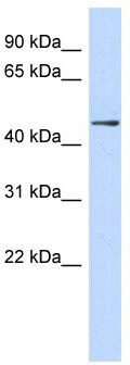 WB Suggested Anti-ZNF391 Antibody Titration: 0.2-1 ug/ml; ELISA Titer: 1:312500; Positive Control: Human Lung