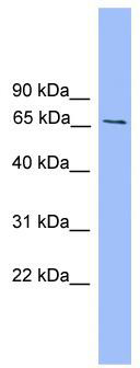 WB Suggested Anti-Smad4 Antibody Titration: 0.2-1 ug/ml; ELISA Titer: 1:312500; Positive Control: Mouse Brain