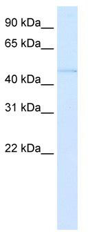 WB Suggested Anti-PAX3 Antibody Titration: 0.2-1 ug/ml; ELISA Titer: 1:1562500; Positive Control: Human Lung