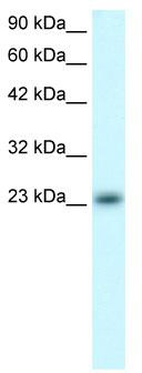 WB Suggested Anti-MXD4 Antibody Titration: 0.2-1 ug/ml; ELISA Titer: 1:312500; Positive Control: Jurkat cell lysate