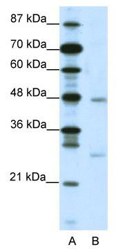 WB Suggested Anti-MXD4 Antibody; Titration: 2.5 ug/ml; Positive Control: Jurkat Whole Cell