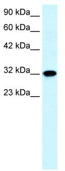 WB Suggested Anti-AQP7 Antibody Titration: 0.2-1 ug/ml; Positive Control: Human heart