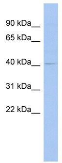 WB Suggested Anti-MSL3L1 Antibody Titration: 0.2-1 ug/ml; ELISA Titer: 1:312500; Positive Control: OVCAR-3 cell lysateMSL3 is supported by BioGPS gene expression data to be expressed in OVCAR3