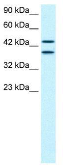 WB Suggested Anti-C14ORF131 Antibody Titration: 0.3-0.5ug/ml; Positive Control: HepG2 cell lysateZNF839 is supported by BioGPS gene expression data to be expressed in HepG2